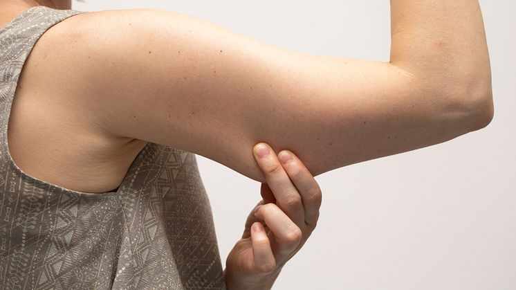 Bingo Wings, Armpit Fat & Accessory Breasts: Why they won’t respond to non-invasive treatments
