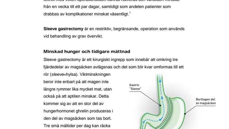 Fakta om sleeve gastrectomy – kirurgisk behandling av grav övervikt