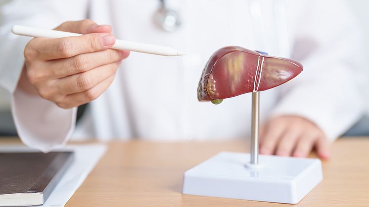 Som de første i verden har danske Cysbio udviklet en billig og mere miljøvenlig måde at fremstille aminosyren serin på. Produktet kan forebygge sygdommen fedtlever, og omsætningen vil i 2024 overstige 50 millioner kroner.. Foto: Cysbio.