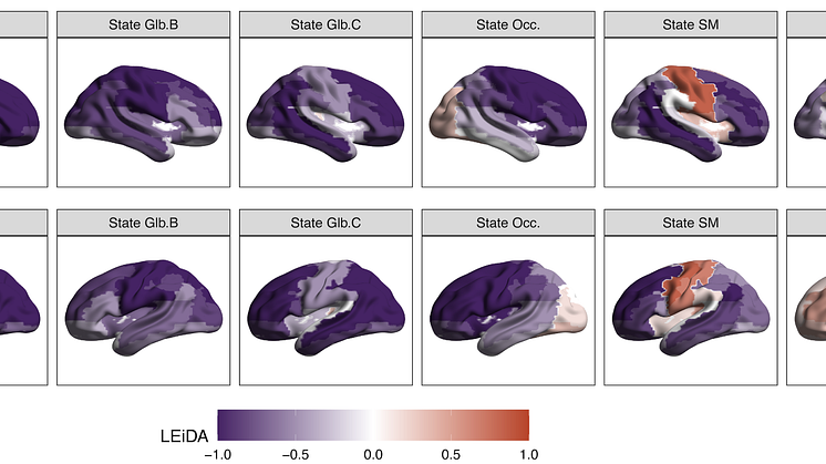 The study identified six different brain states and that brain state dynamics at birth are linked to developmental outcomes in early childhood