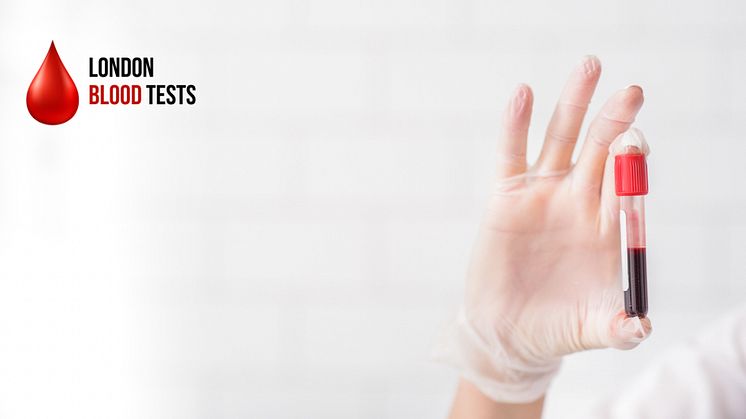 6 Essential Blood Tests for Gaining Health Insights and Understanding Your Well-being