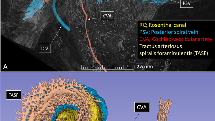 Cochlea blood vessel