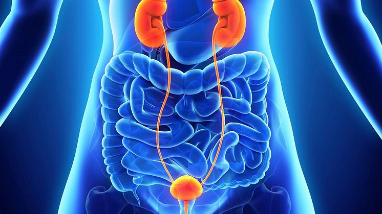 Lokalt avancerad eller metastaserad urotelial cancer (UC)
