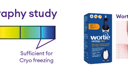 Wortie Freeze Pro Thermography Study