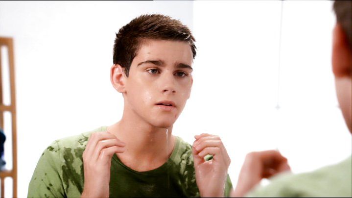 Reklamfilm Clear Face Acne