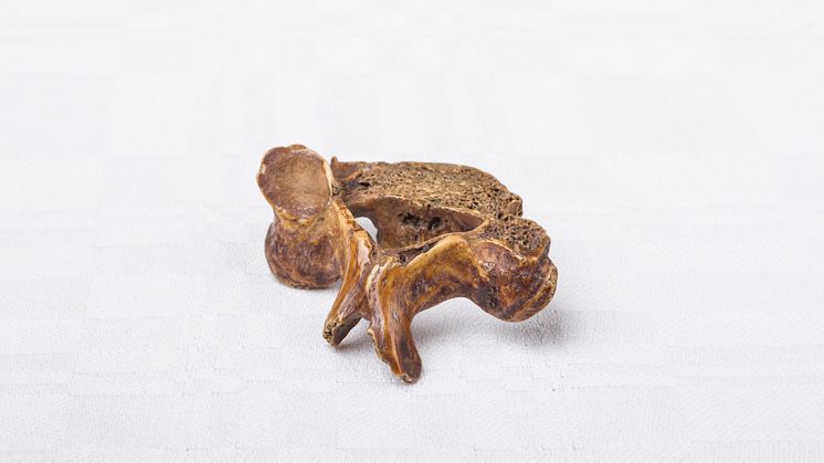 Neck vertebra from medieval king 