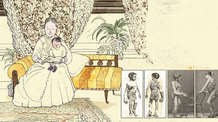 Elefantmannen som liten