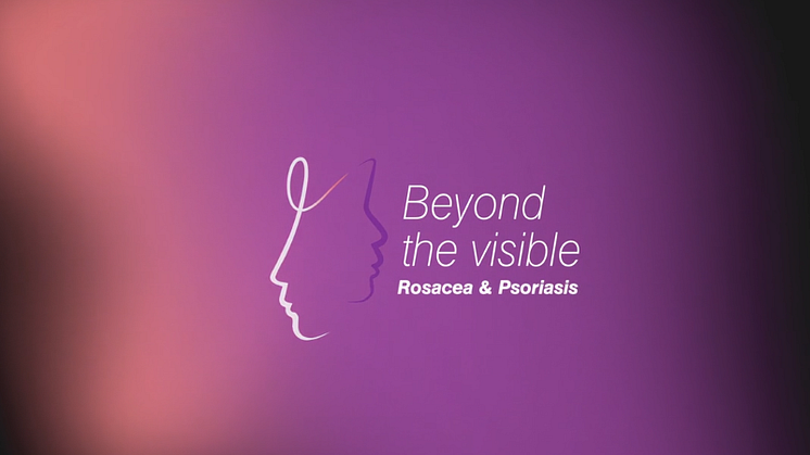 Rosacea 2