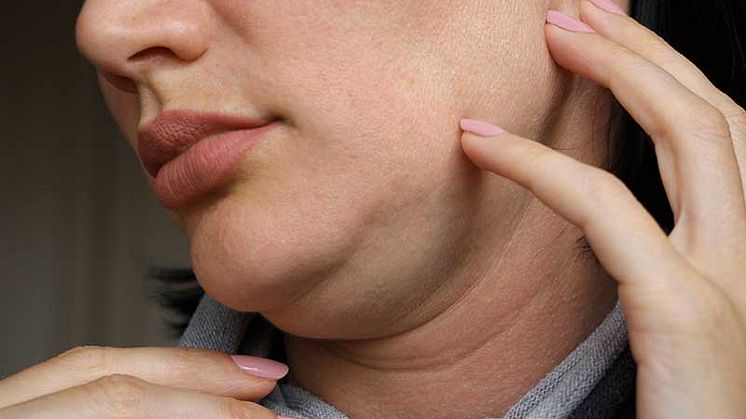 61ee5251c5f14e61ac2f4101_double-chin-liposuction.jpg