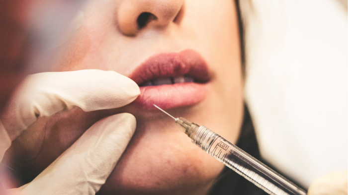 Face tweakment is on the rise, but what happens when you have one too many dermal fillers?