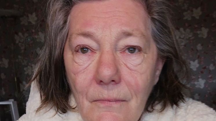 Christina har levt med typ 1-diabetes i 48 år ﻿