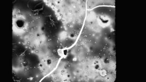Size of an Adenovirus by Gustaf Kylberg