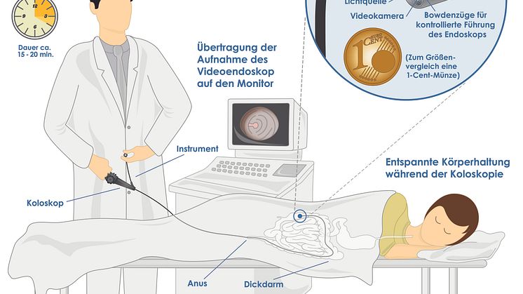 Koloskopie des Dickdarms