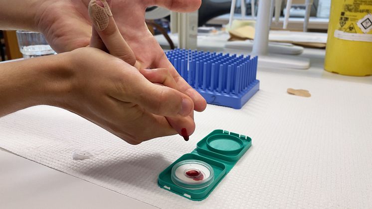 Ny metod gör det möjligt att screena för autoimmuna sjukdomar i stor skala 
