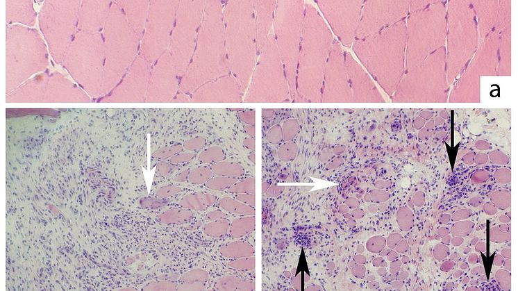 Normal muskelmorfologi hos kontrolldjur (a) där muskelfibrer ligger tätt packade. B och c visar områden med muskelinflammation från experimentdjur och hur vita blodkroppar invaderat in i den lösa bindväven. Bild: Lina Renström.
