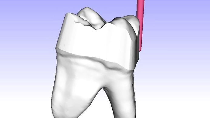 Virtual grinding of the tooth