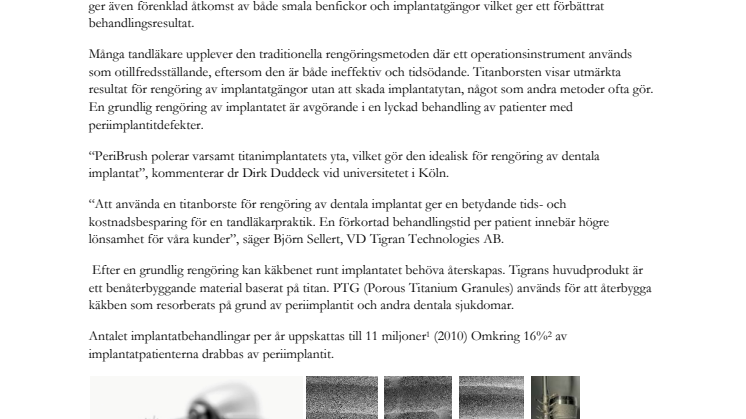 Tigran: Nytt instrument förkortar behandlingstid av tandvårdspatienter avsevärt