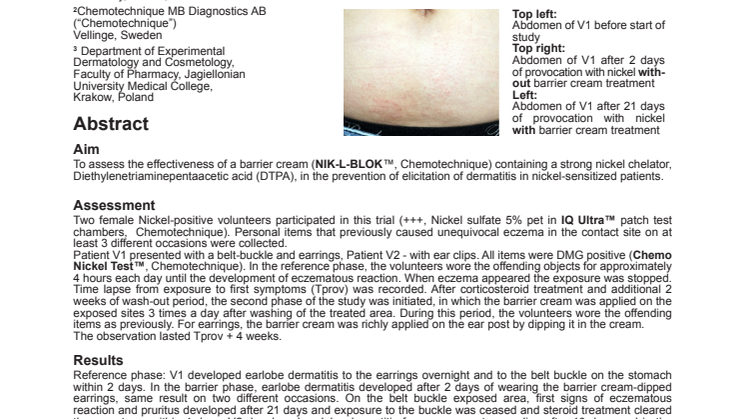A novel barrier cream is effective in preventing allergic contact dermatitis from nickel releasing items