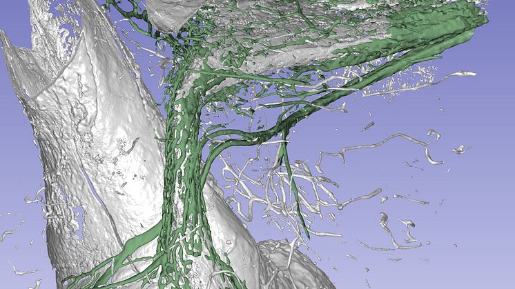 A synchrotron X-ray of the balance organ of the human inner ear.