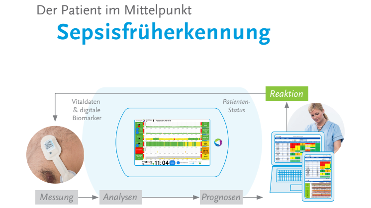Der Patient im Mittelpunkt: Sepsisfrüherkennung