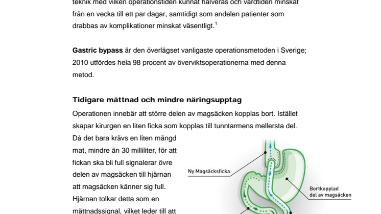 Fakta om gastric bypass