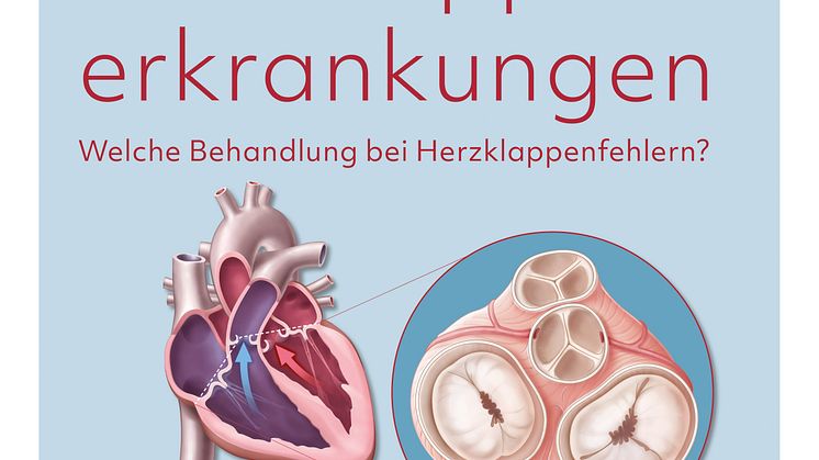 Cover-Broschüre_Herzklappen