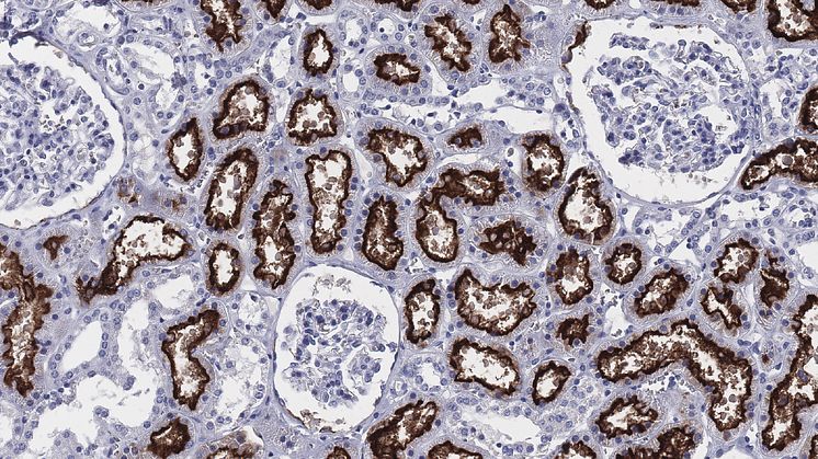 Bilden visar hur enzymet ACE2 (brunfärgat) uttrycks i njuren. Forskarna har kartlagt det celltypspecifika uttrycket av ACE2 i mer än 150 olika mänskliga celltyper. Foto: Human Protein Atlas