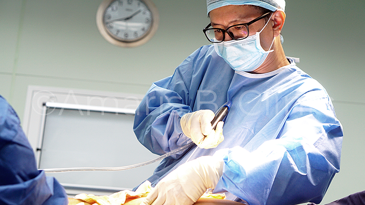 Amaris B. Clinic Is Seeing More Patients for Liposuction Due To Inefficacy of Non-surgical Fat Reduction Treatments 