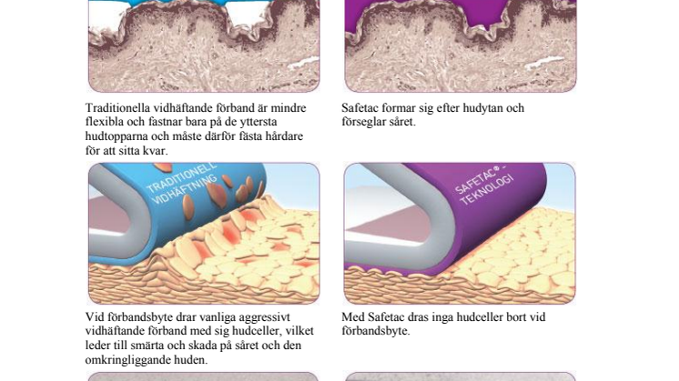 Så fungerar Safetac-teknologin