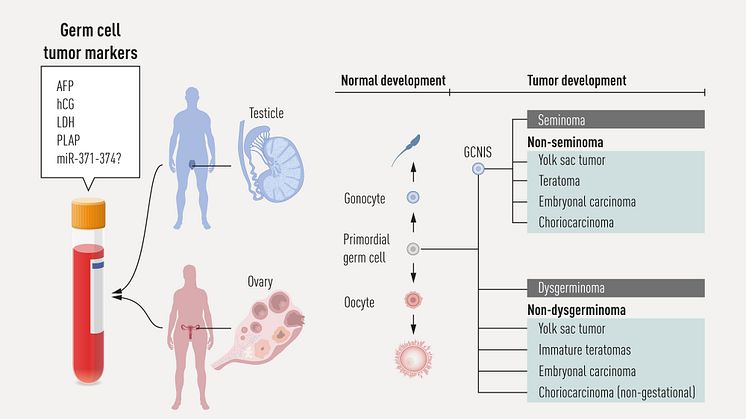 Riskfaktorer germinalcellscancrar