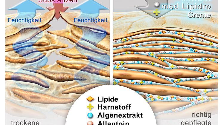 Wie entsteht trockene Haut?