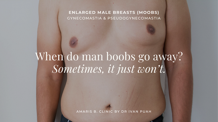 When do man boobs go away? Sometimes, it just won’t.