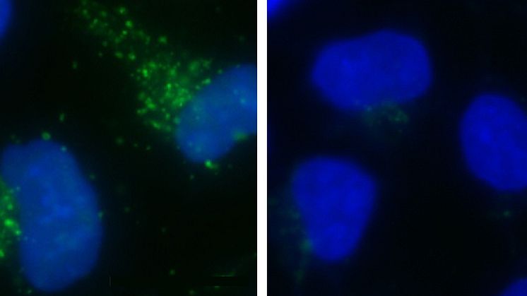 Protein identified that can lengthen our life?