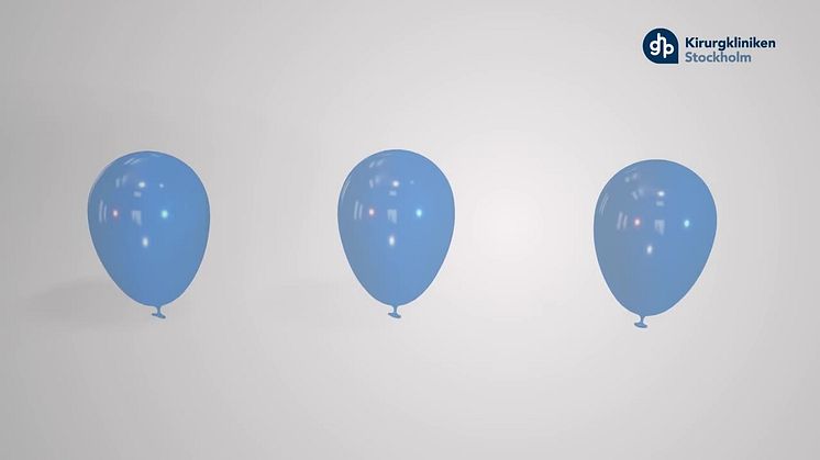 Gastrisk ballong 