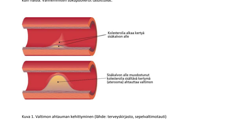 Taustatietoa sepelvaltimotaudista