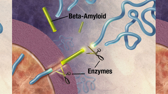 Bild från Wikimedia - Amyloid