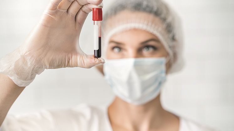 Neue Laboranalytik von Vitamin K2