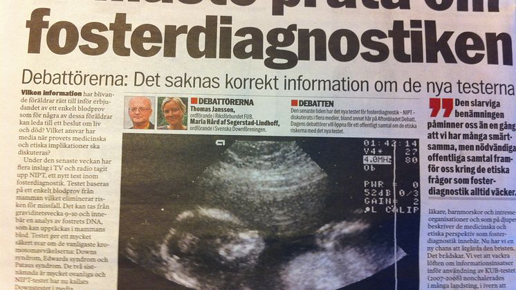 Riksförbundet FUB och Svenska Downföreningen skriver debattartikel om NIPT