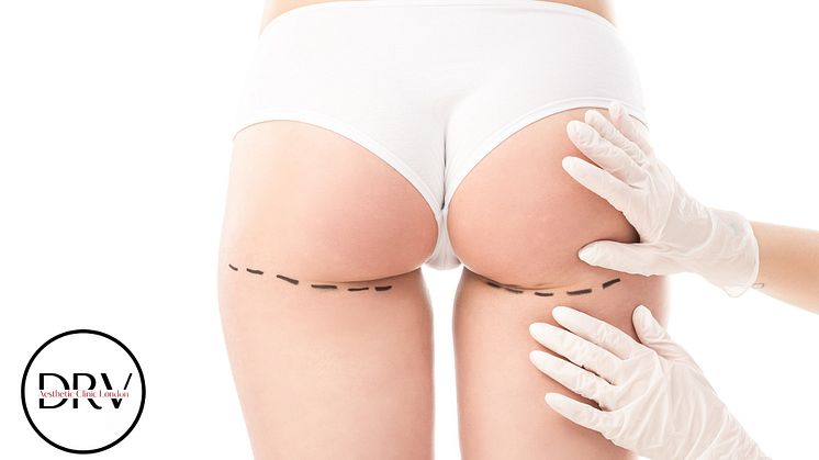 DRV Clinic offers Brazilian Butt Lift (BBL) in various locations such as London, Turkey and Romania. Book Now a Consultation to see your price options!