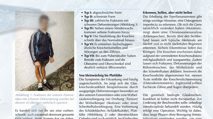 Osteogenesis imperfecta: Die Glasknochenkrankheit 