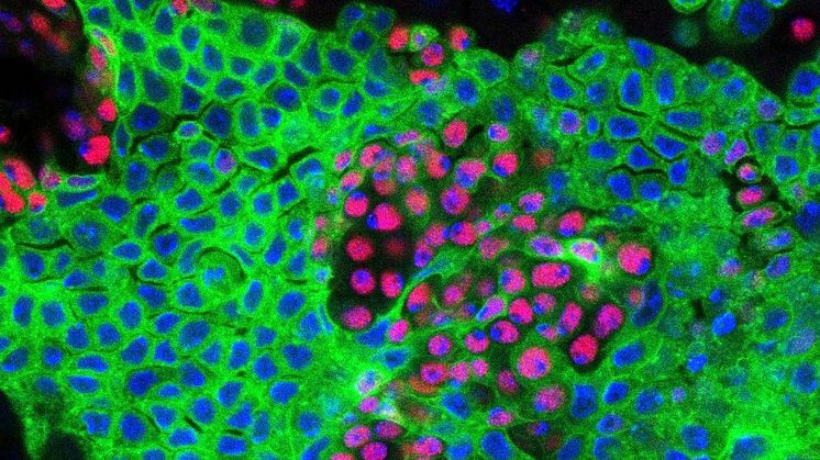 Protein kan bromsa tumörers tillväxt i tarmen