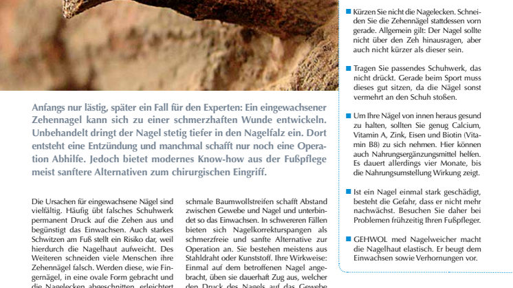 Nagelprobleme: Unkomplizierte Hilfe bei eingewachsenen Nägeln