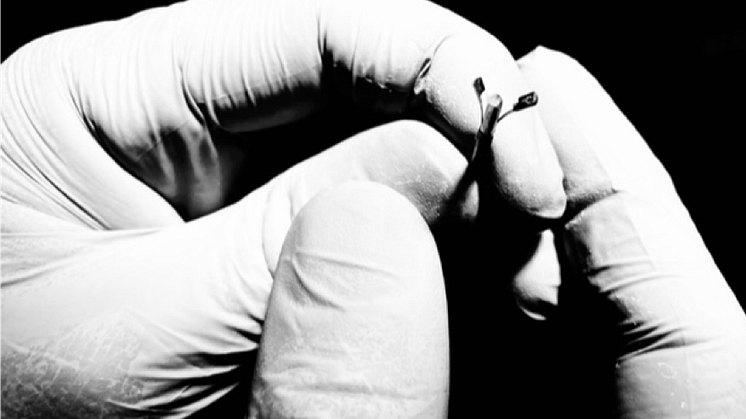 Världsny revolutionernade patenterad teknik för cancerbehandling på 20 minuter på vaken patient som går hem direkt efteråt