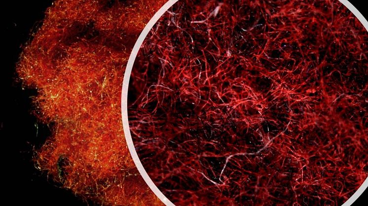 striking image from microscope of cotton and polyester fibres collected from tumble dryer exhaust