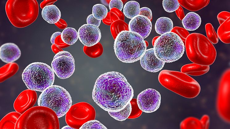 leukemi - blodceller - genre - iStock-1059134930