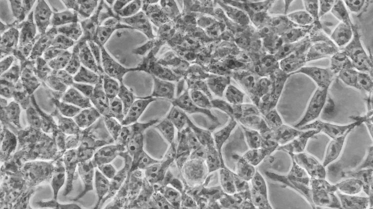 Human kidney cells