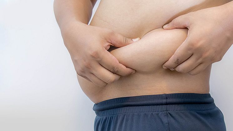 Will fat return after liposuction?