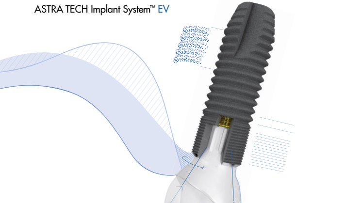 System brochure ASTRA TECH Implant System EV 
