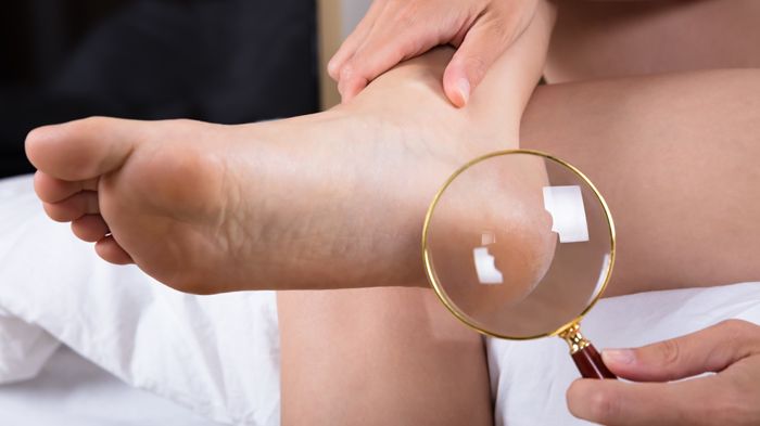 Die tägliche Fußinspektion und verletzungsfreie Fußpflege gehört zu den Schulungszielen für Diabetiker. Sie sollen dazu beitragen, den typischen Fußproblemen bei Diabetes vorzubeugen. Bild:  Andrey Popov | fotolia
