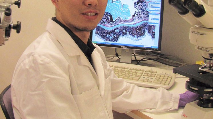 Discovery of a novel medicine for the treatment of chronic wounds